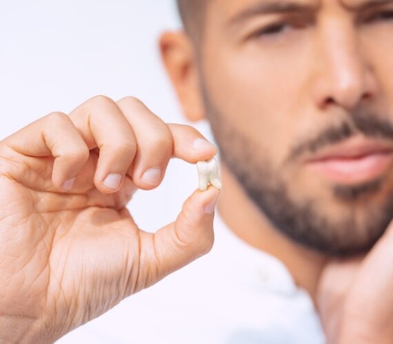 Emergency Dental Tips To Save Knocked-Out Tooth