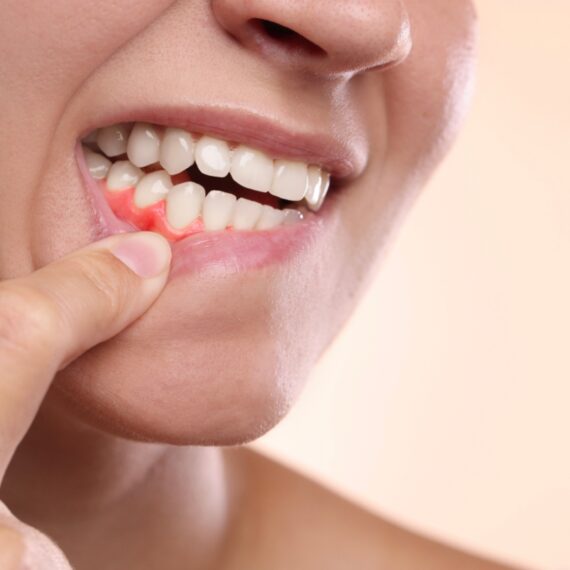 Gum-Disease-Treatment-in-New-York